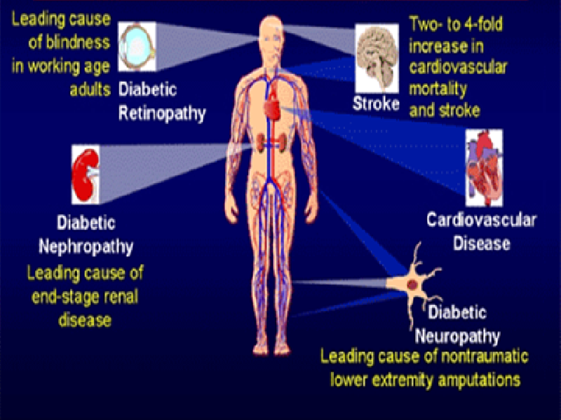 Genito Urinary Problems In Diabetes Mellitus
